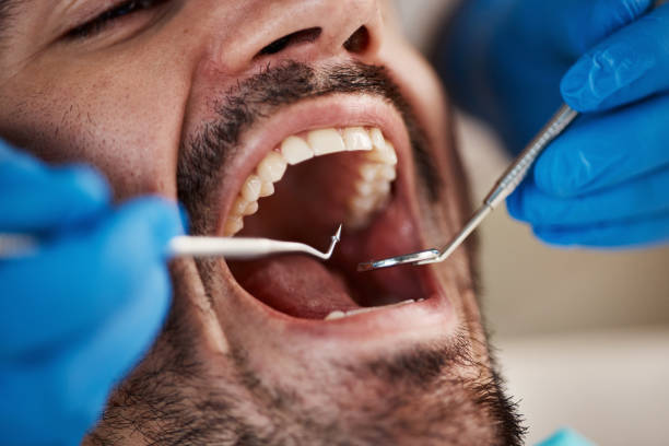 Best Emergency Cosmetic Dentistry in Blue Mound, IL
