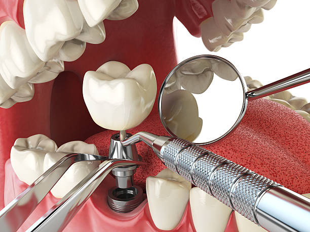 Best Urgent Dental Care for Toothache in Blue Mound, IL